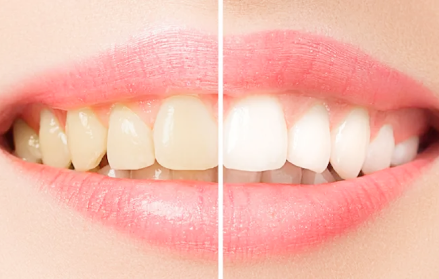 エクシアが選ばれる理由2